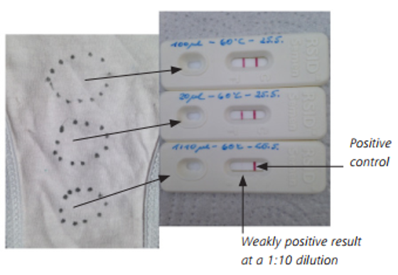 Phát hiện tinh trùng trong mẫu vải đã giặt bằng kính hiển vi sau khi nhuộm HY-LITER