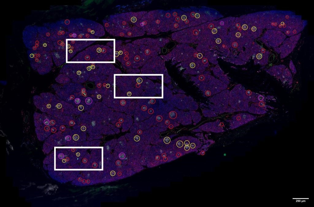 ZEISS Axioscan quét toàn bộ tiêu bản tuyến tụy giúp nghiên cứu bệnh tiểu đường tuýp I
